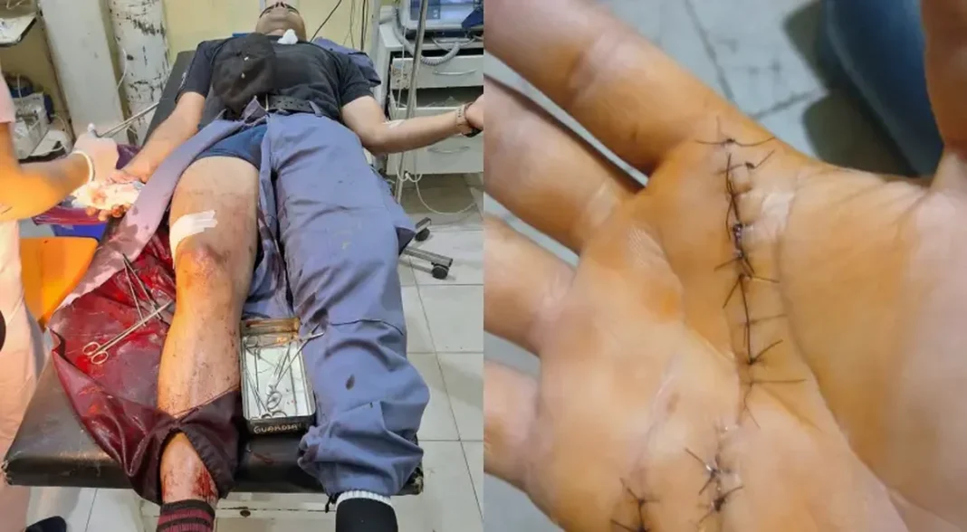 El sargento permanece en una camilla con heridas en el muslo y puntos de sutura en la mano.